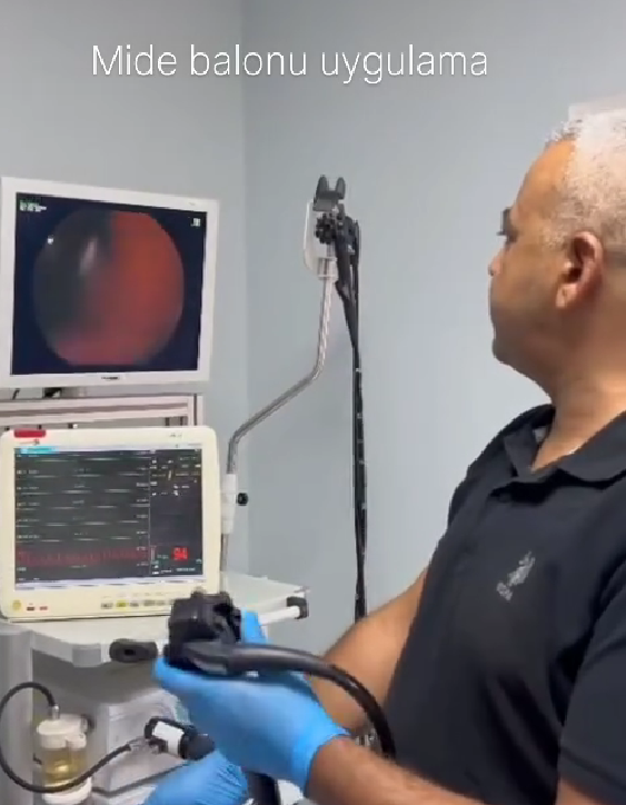 Mide Balonu İşlemi